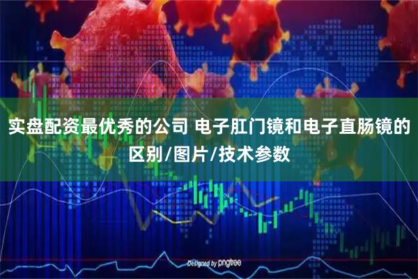 实盘配资最优秀的公司 电子肛门镜和电子直肠镜的区别/图片/技术参数